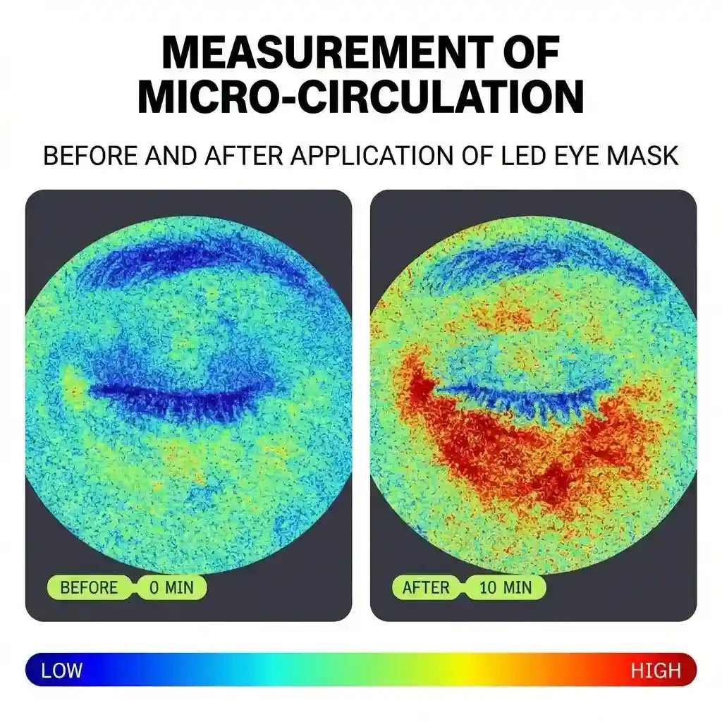 LOVYMI® | LED Eye Mask - Say Goodbye to Dark Circles & Tired Eyes  LED Therapy That Works in Just 10 Minutes a Day