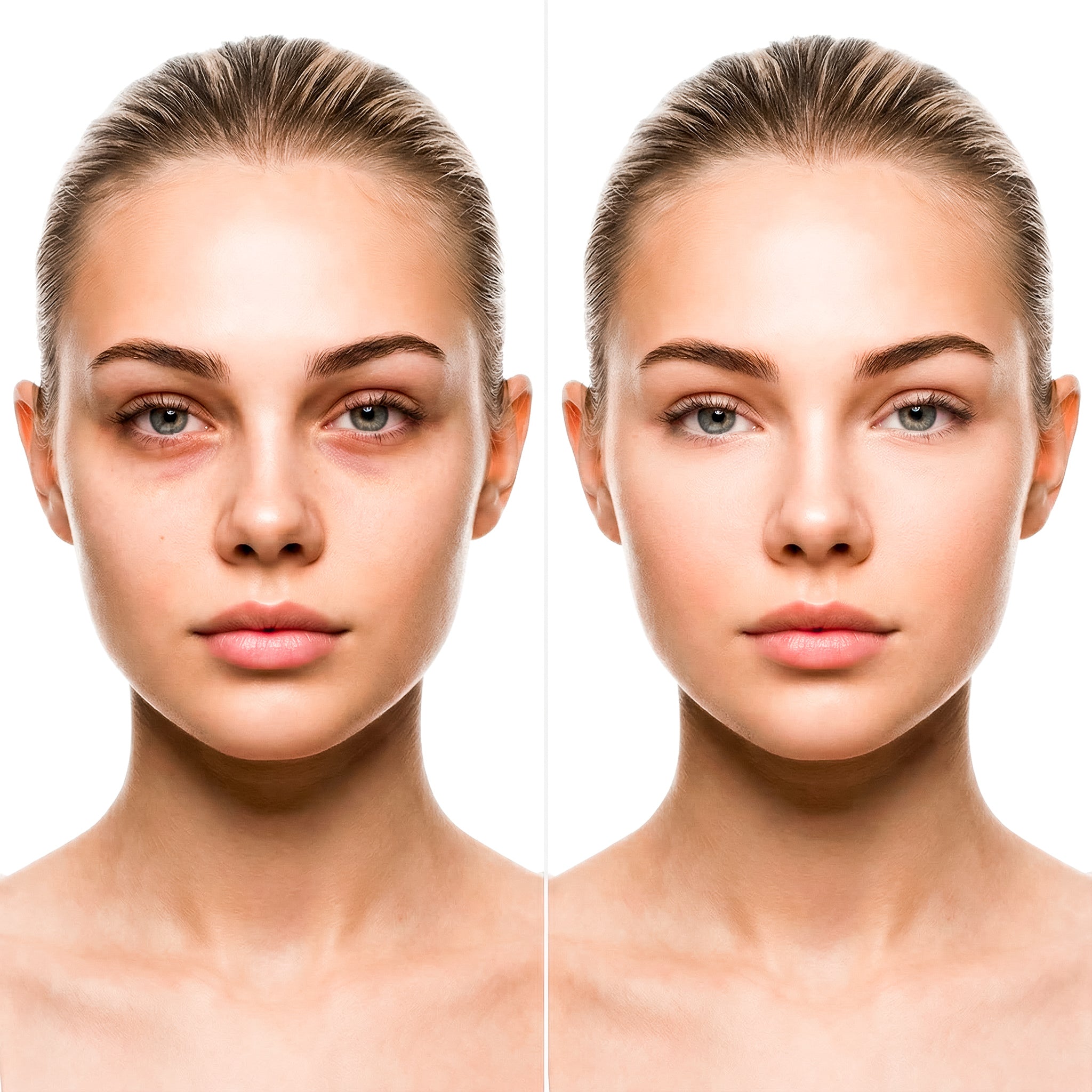 LOVYMI® | LED Eye Mask for Younger-Looking Eyes